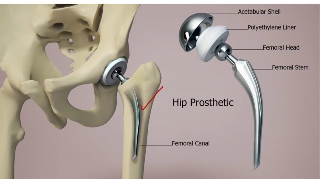 The Rising Need for Canine Orthopedics Market Drives Adoption 