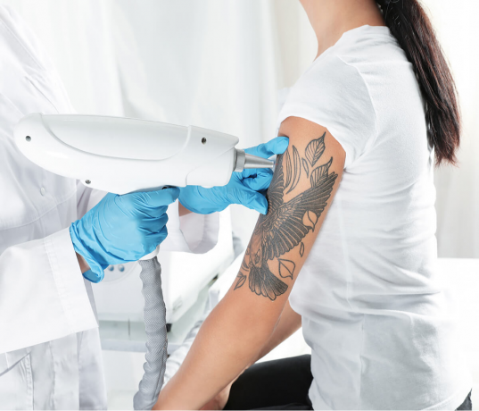 The Truth About Laser Tattoo Removal in Dubai: What You Need to Know