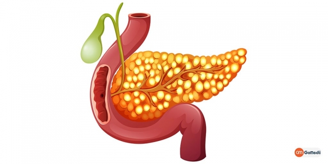 Pancreatic Cancer Treatment: Options and What You Need to Know