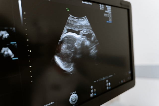 What Is an OBGYN?
