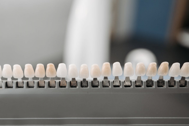 How to Care for Your Veneers for Long-Lasting Results