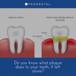 10 Reasons to Choose Invisalign for a Perfect Smile