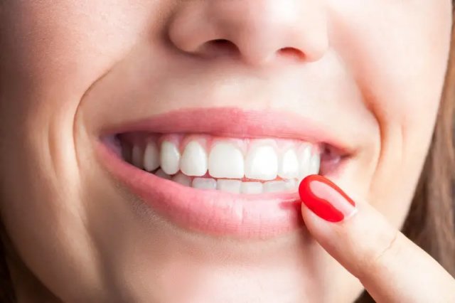 Composite Bonding Your Fast Track to a Beautiful Smile