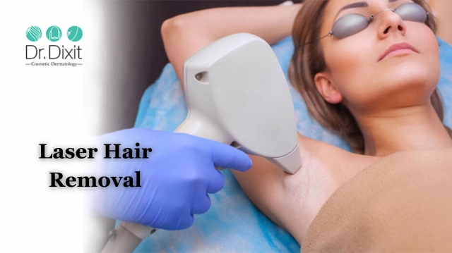 Is Laser Hair Removal Safe? What You Should Knows