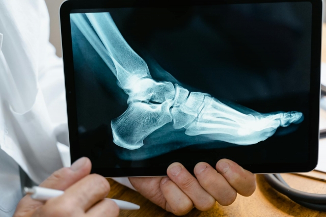 Expert Legal Representation: How a Jacksonville Personal Injury Lawyer Can Help You Recover