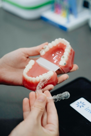 Invisalign for Teens: Unique Benefits and Features
