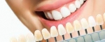 The Customizable Smile: Exploring the Versatility of Veneers