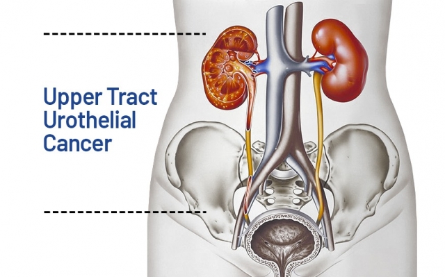 Urothelial Carcinoma Market Size, Share, Trends, Industry Report 2024-34