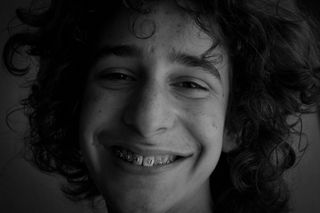 The Evolution of Braces