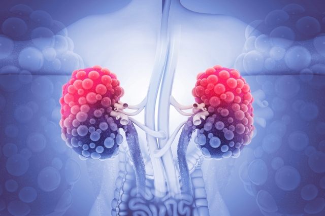 Autosomal Dominant Polycystic Kidney Disease Market Growth, Size by 2032