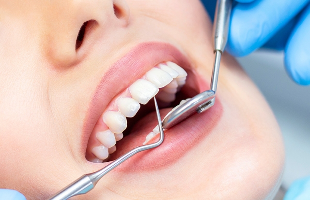 Non-Prep Veneers The Smarter Way to Enhance Your Smile