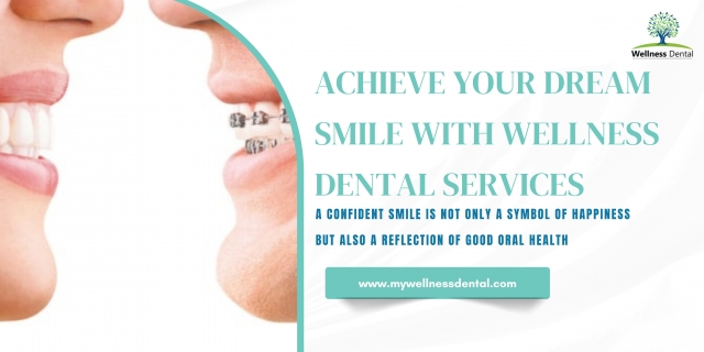 Achieve Your Dream Smile with Wellness Dental Services