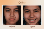 Best Skin Clinic in Delhi: Alive Wellness Clinics