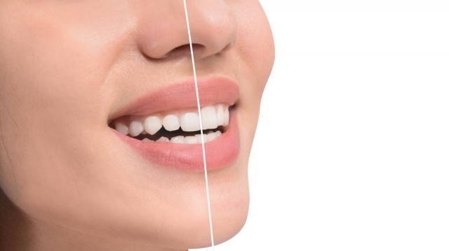 Perfect Your Gum Line with Custom Contouring Treatments