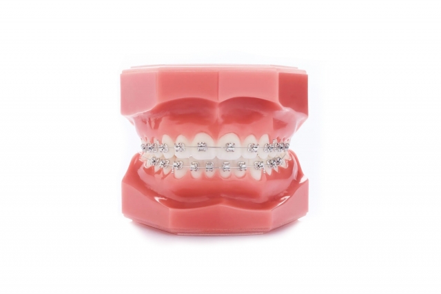 The Long-Term Benefits of Metal Braces: A Journey to a Lifetime of Smiles