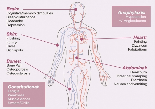 Systemic Mastocytosis Market Share, Industry Trends, Forecast 2024-34