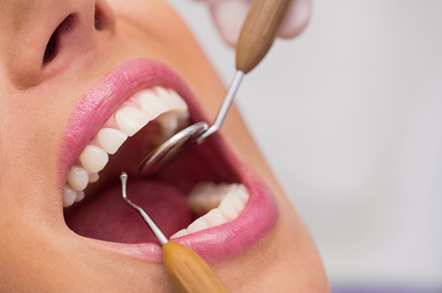 The Journey to a Brighter Smile: Teeth Polishing Explained