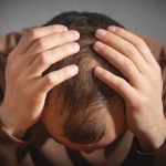Is Hair Transplant Surgery Safe in Islamabad?
