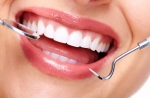Polishing and Scaling, The Best Way to Care for Your Teeth