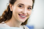 Maintaining Your Dental Braces: A Complete Care Guide