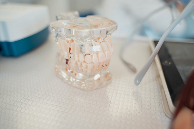 A Comprehensive Guide to Solutions for Missing Teeth 