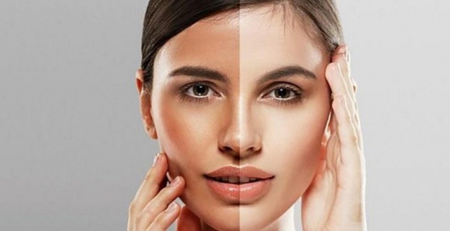 The Role of Skin Toning Treatment in Islamabad: What to Expect