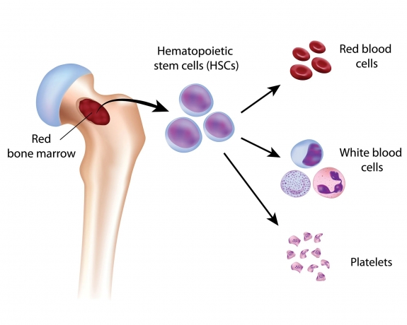 Myelodysplastic Syndrome Market Growth Analysis, Trends, Report 2024-34