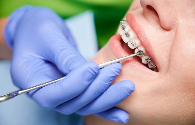 Combining Braces and Surgery: Advanced Treatments for Complex Cases