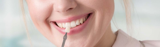 Everything You Need to Know About Non-Prep Veneers and Their Benefits