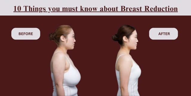 10 Things you must know about Breast Reduction