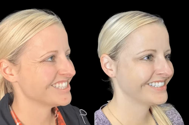 Insider Tips: Best Aesthetic Clinic in Dubai for Botox Success