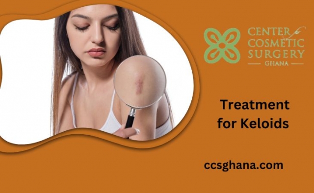 Treatment for Keloids in Ghana: Surgical Solutions for Lasting Relief