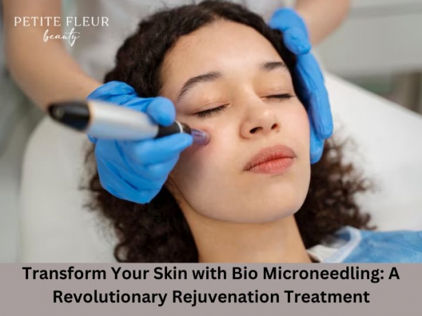 Transform Your Skin with Bio Microneedling: A Revolutionary Rejuvenation Treatment
