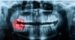 The Complete Guide to Panoramic X-Ray Imaging for Teeth