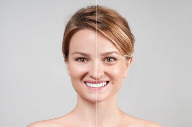 Top 5 Botox Providers in Sarasota, FL: Discover the Best Options for Your Skin