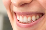 Gum Contouring for a Perfectly Proportioned Smile