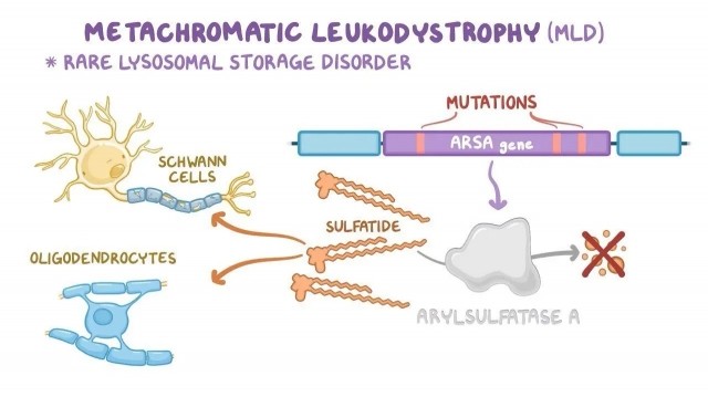 Metachromatic Leukodystrophy Market Outlook, Industry Size, Growth Factors, Investment Opportunity 2024-2034