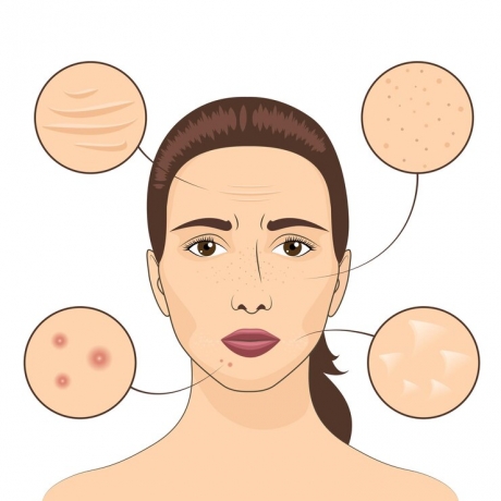 Actinic Keratosis: A Common Skin Condition Caused by Sun Damage