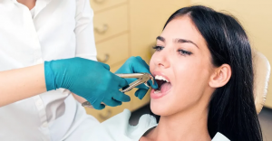 Wisdom Teeth Extraction in Artesia, CA