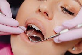 Full Mouth Restoration, A New Beginning for Your Teeth