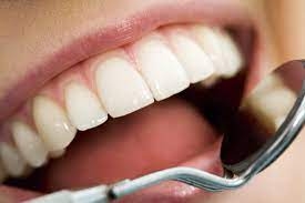 Nano Whitening Technology for the Perfect Smile