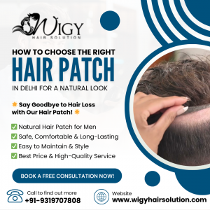 How to Choose the Right Hair Patch in Delhi for a Natural Look