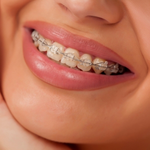 How Can Orthodontics Help with Jaw Pain and Misalignment?