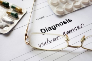 Vulvar Cancer Drugs Market to Witness Strong Growth Owing to Increasing Incidence of Vulvar Cancer
