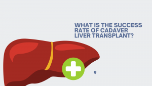 What is the Success Rate of Cadaver Liver Transplant?