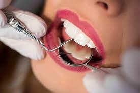 Protecting Your Smile with General Dental Care