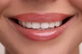 How Bonding Cement Helps Enhance Your Teeth’s Appearance
