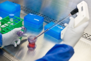 Global Immunocytokines Market is Estimated to Witness High Growth Owing to Technological Advancements 