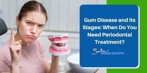 Gum Disease and Its Stages: When Do You Need Periodontal Treatment?