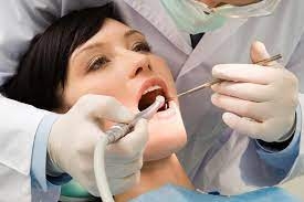 How Tooth Fillings Can Save Your Teeth